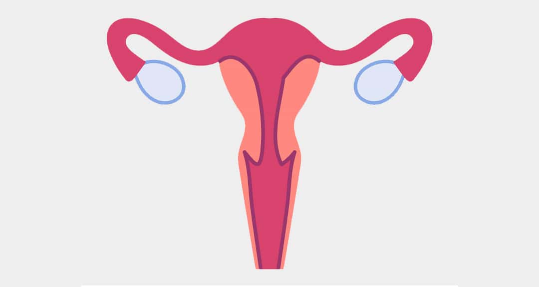 Symptoms and complications of ovarian cyst